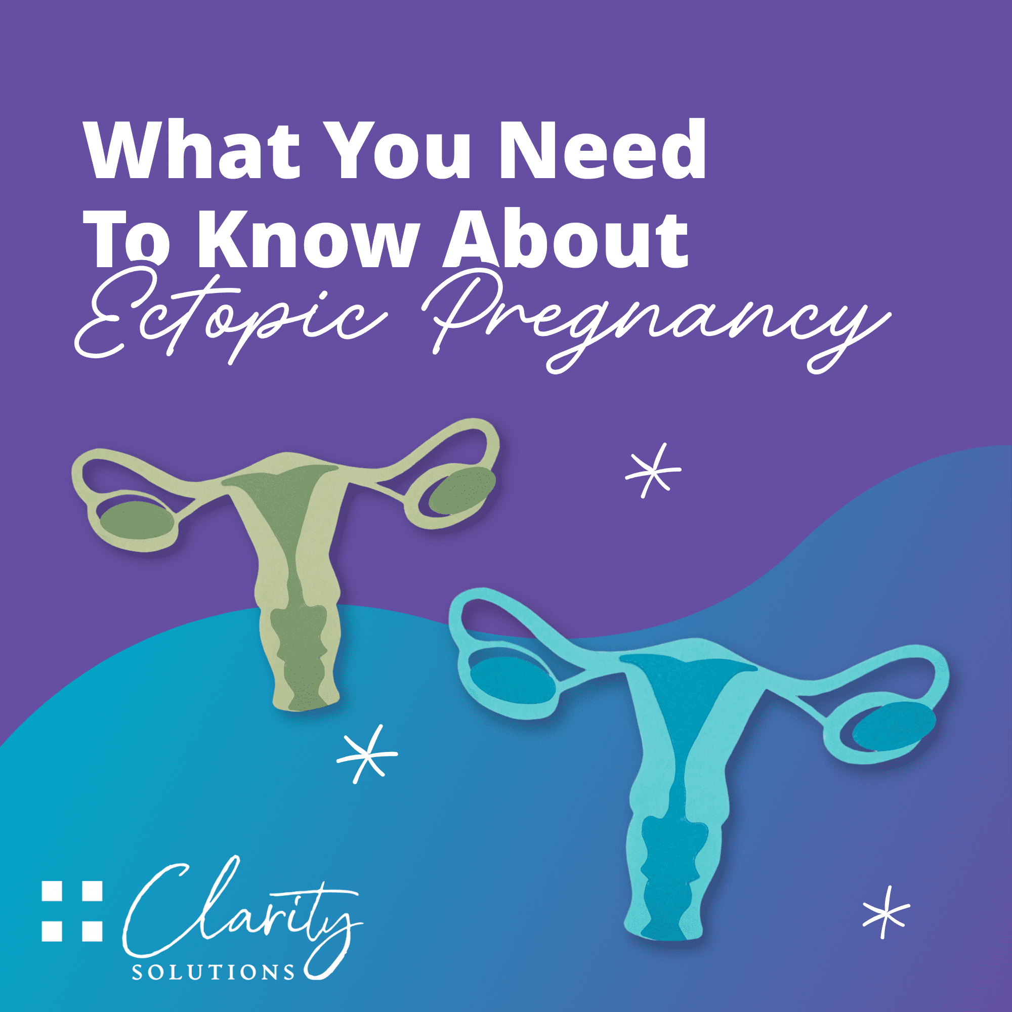 What you need to know about ectopic pregnancy